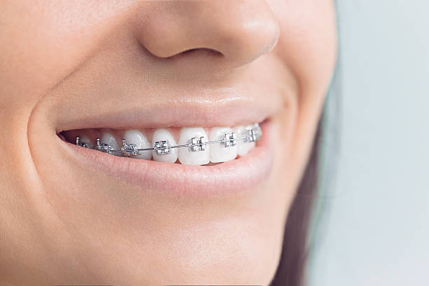 Best Teeth Whitening  in Linthicum, MD